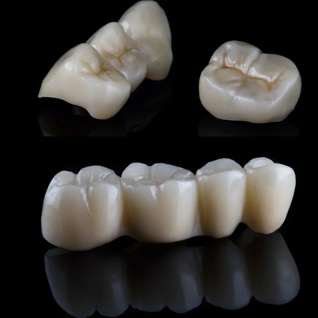 Dental Crowns in Stockbridge GA