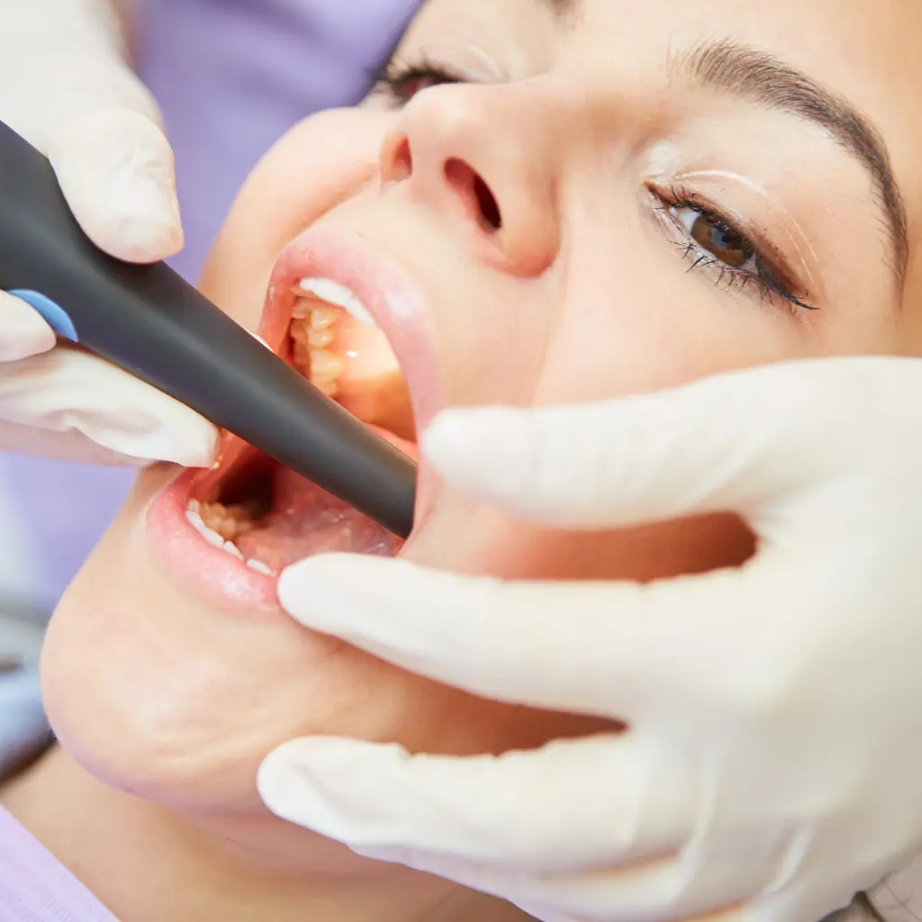 Root Canal Treatment in Stockbridge GA