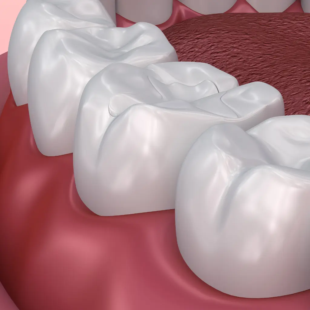 Tooth Fillings in Stockbridge GA